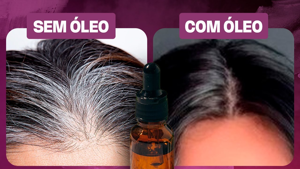 Os seus cabelos brancos merecem cuidados! Conheça agora quais são os Três Melhores Óleos Essenciais