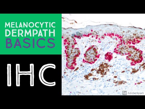 Melanocytic Dermpath Basics: Immunohistochemistry