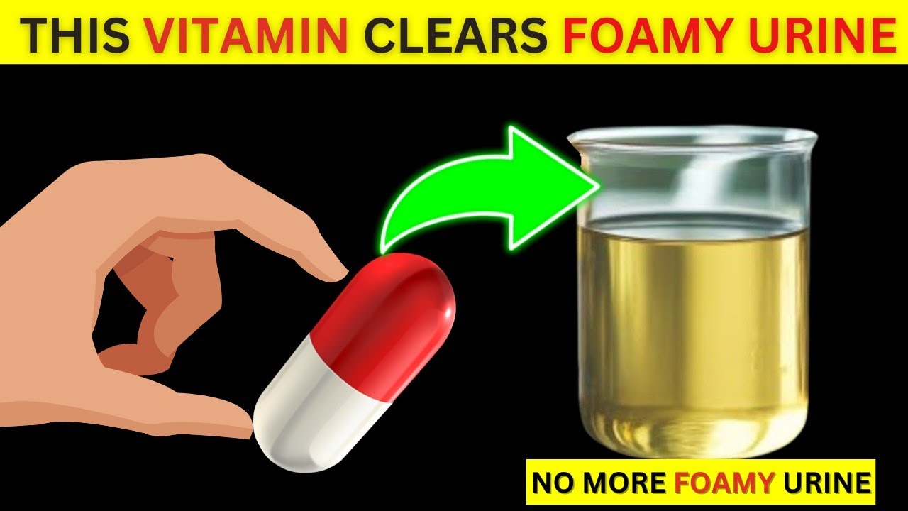 The 4 Vitamins To Stop Proteinuria (Foamy urine) & Revive Kidneys Fast