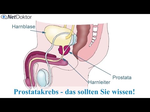 Prosztata méretű prosztatitis