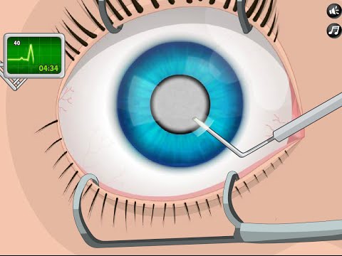 Doctorul Rancaciovean - Eye Surgery