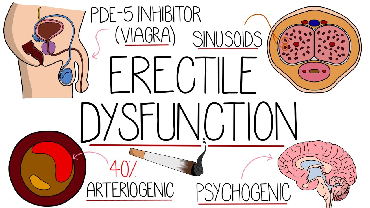 Erectile Dysfunction Explained - It's Not That Hard