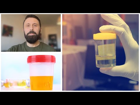 Urina pihet si ilaç? Çudit sërish Altin Joka me teorinë e vjetër të trajtimit të sëmundjeve