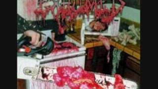 Exhumed - Enucleation