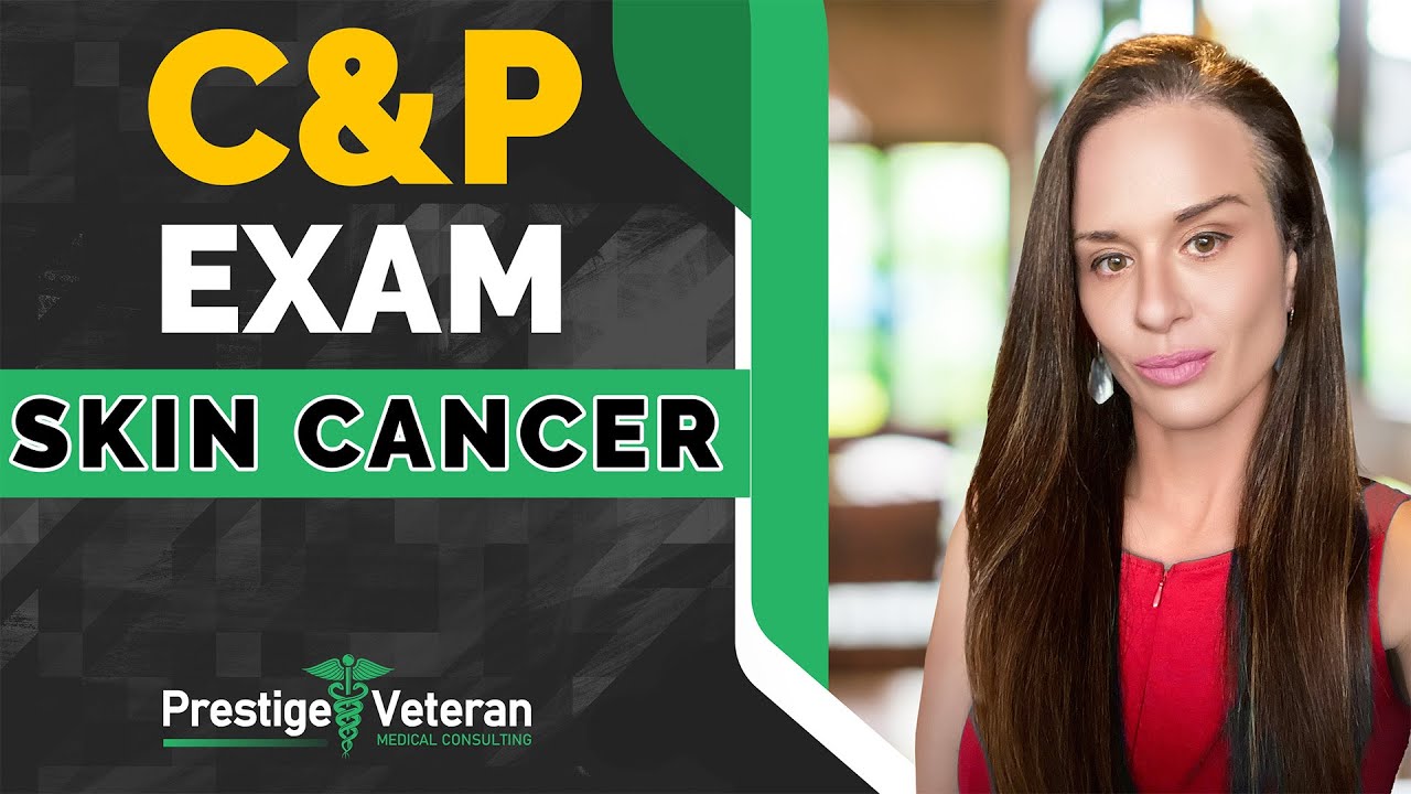 What to Expect in a C&P Exam for Skin Cancer | All You Need To Know