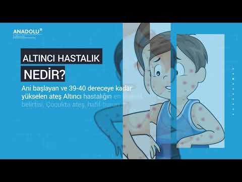 Döküntülü hastalıklar Resim