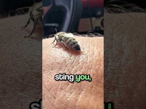 What Should You Do After a Bee Bites You? 🐝🤔