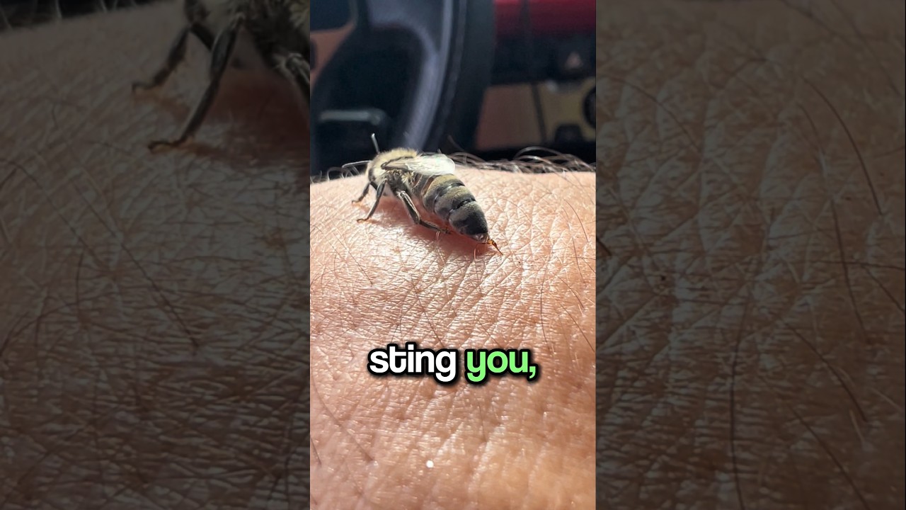 What Should You Do After a Bee Bites You? 🐝🤔