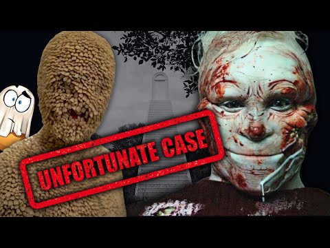 The Unfortunate Case of Channel Zero