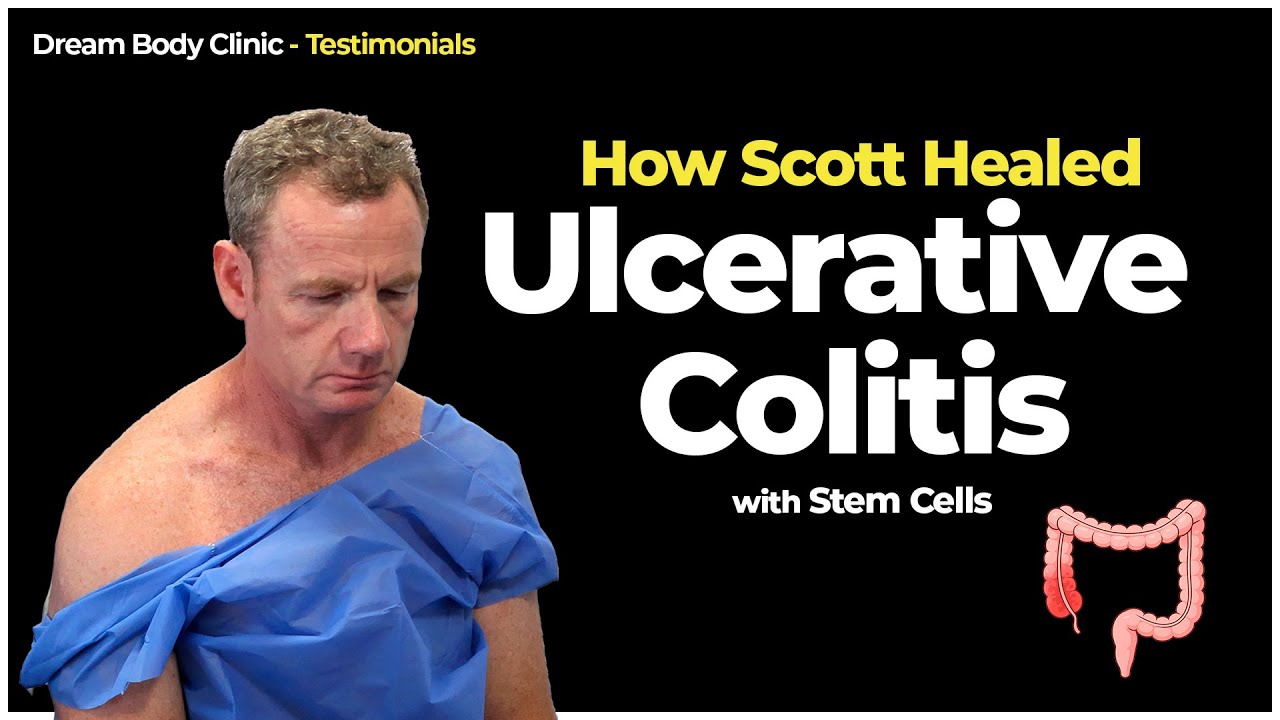 How Scott Healed Ulcerative Colitis with Stem Cells | DBC Stem Cells 2026