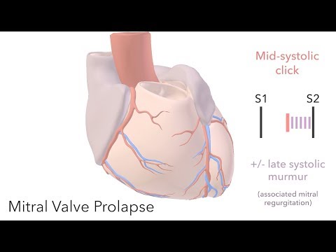 Mitral Valve Prolapse - sound & animation