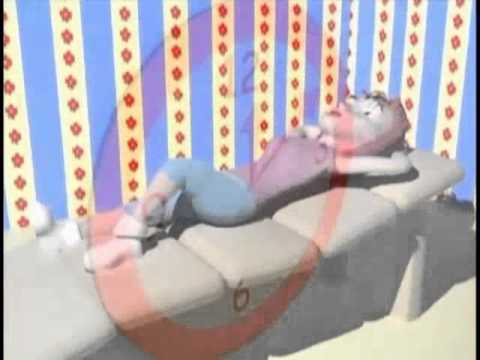 LIPOASPIRACION LASER - Doctor FRANCISCO SALES PUCCINI