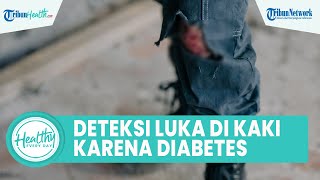 Cara Mendeteksi Luka Kaki akibat Penyakit Diabetes, Cek Kadar Gula hingga Imunitas Alami Penurunan
