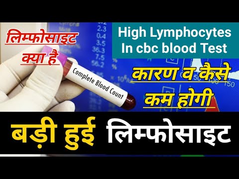High Lymphocytes In Blood Test, Causes, Treatment | high lymphocytes in hindi, लिम्फोसाइट्स क्या है