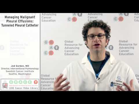 Managing Malignant Pleural Effusions: Tunneled Pleural Catheter
