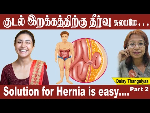 குடல் இறக்கத்திற்கு தீர்வு சுலபமே | Solution for Hernia Is easy …. | #daisythangaiyaa#daisyhospital