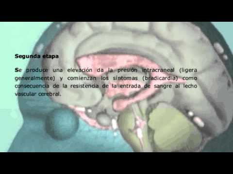 Para tratar los dientes hipertensión Historial médico de Farmacología enfermedad hipertensiva