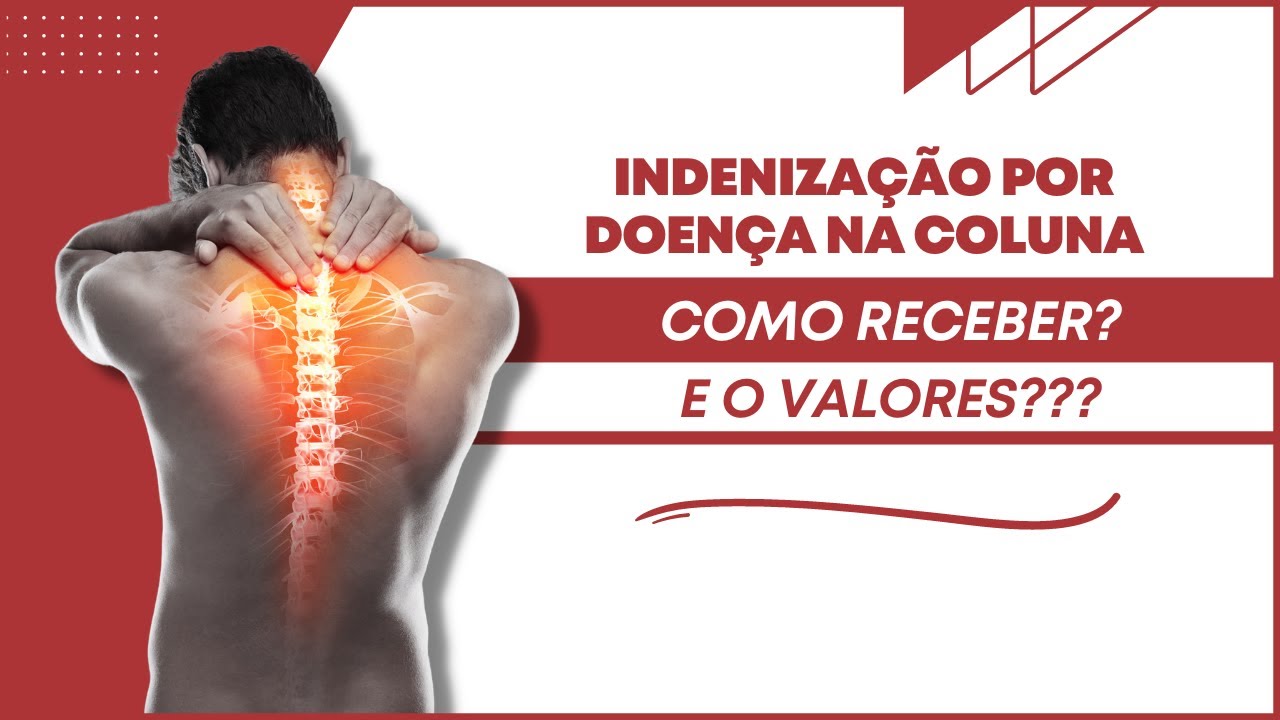 INDENIZAÇÃO Trabalhista PROBLEMA NA COLUNA