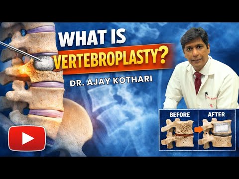 What Is Vertebroplasty? Procedure, Benefits, & Case Studies | Dr. Ajay Kothari