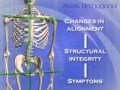 Was Ist Atlas Orthogonal