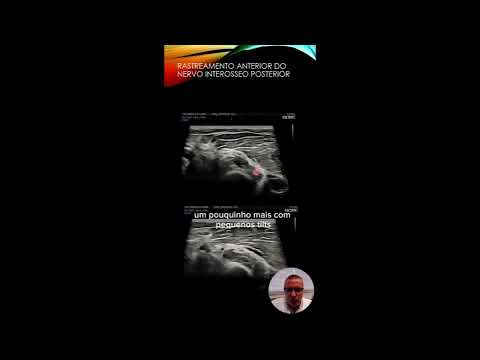 Lindolfo Henriques-18