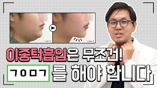 이중턱지방흡입으로 효과 없다면?! #이중턱근육묶기#아이루미성형외과