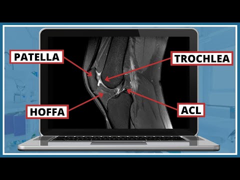 How to read a knee MRI?