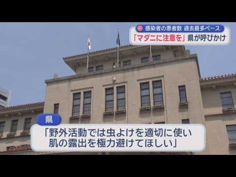 YouTube Video 秋に活動が活発になるマダニにかまれないよう静岡県が注意呼びかけ「虫よけを適切に使い肌の露出を極力避けてほしい」