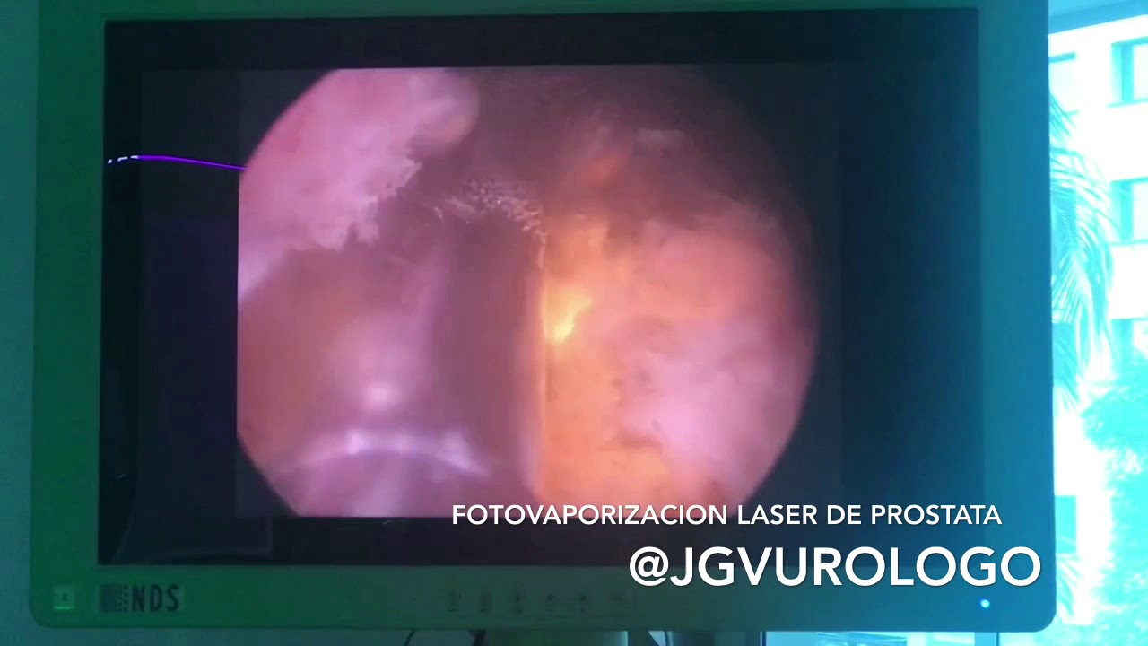 Juan Guillermo Velásquez López-28