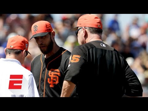 Madison Bumgarner could miss 6-8 weeks with broken bone in hand after being hit by line drive | ESPN