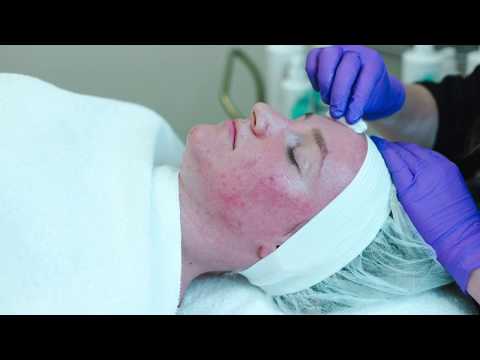 Kosmyq Jesseners Peel