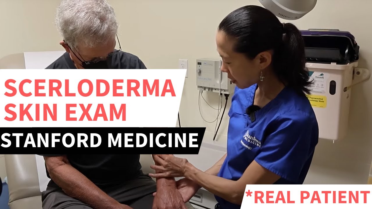 Stanford Rheumatologist SCLERODERMA Skin Exam - YouTube