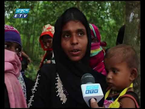 রোহিঙ্গা ক্যাম্পের ১ লাখ ৭৬ হাজার শিশু অপুষ্টিজনিত বিভিন্ন রোগে ভুগছে