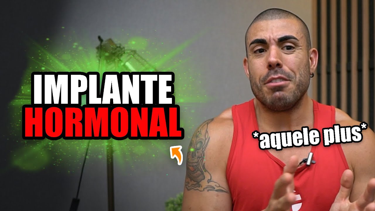 Tudo sobre implante hormonal