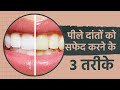पीले दांतों को सफेद कैसे करें How To Whiten Teeth At