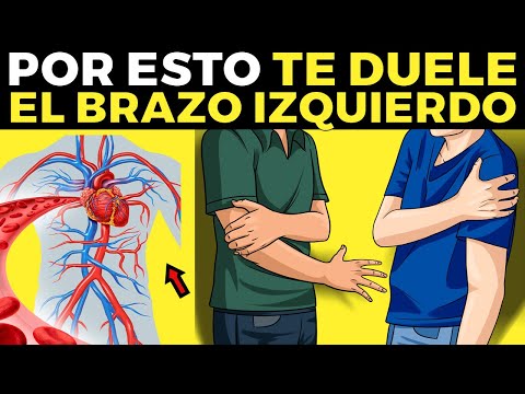 Las Principales Causas y Características Del Dolor En El Brazo Izquierdo