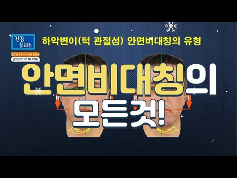 방송으로 본 안면비대칭 비수술 교정