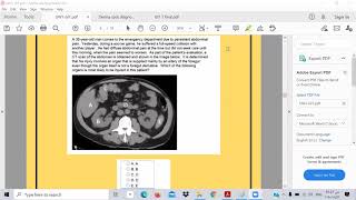 GIT UW 1- Toxic USMLE -Ibrahem Gamal -ابرهيم جمال -شرح وحل معادله امريكية
