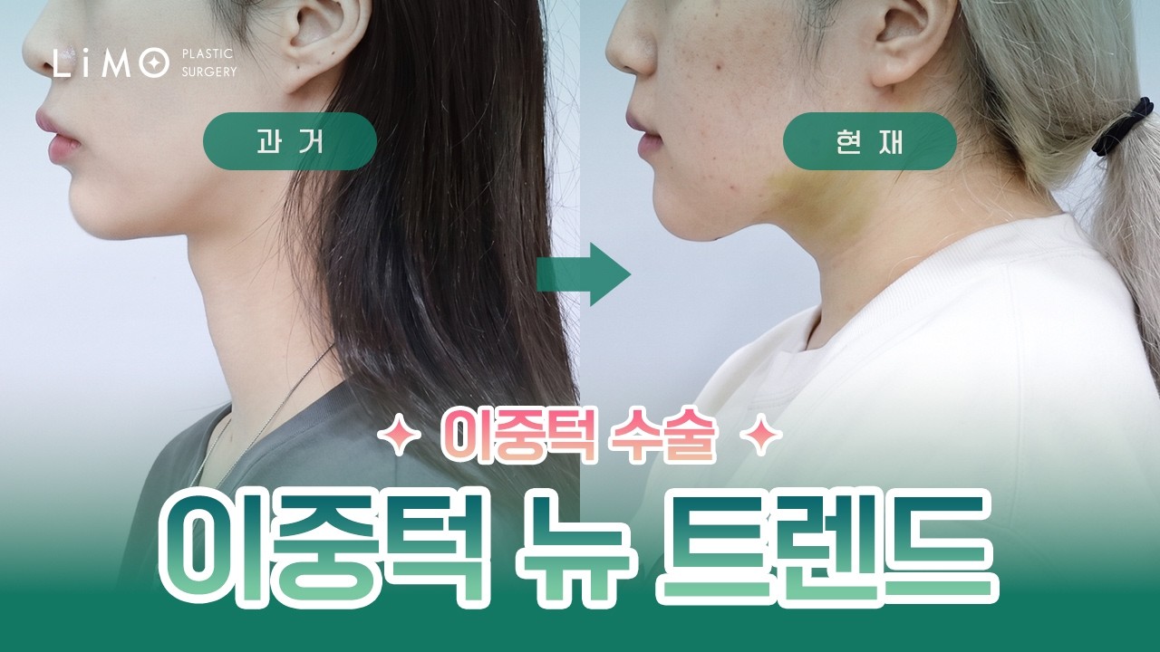 리모성형외과 유튜브 영상