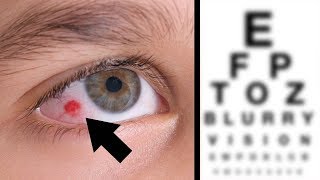 5 Things Your Eyes are Trying to Tell You About Your Health