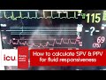 How to calculate SPV and PPV and how to use them for accessing fluid responsiveness in ICU