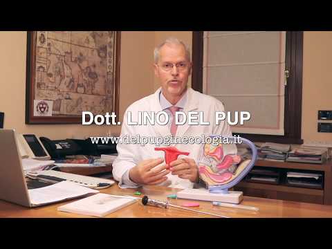 Mestruazioni Anomale e Perdite Ematiche Intermestruali