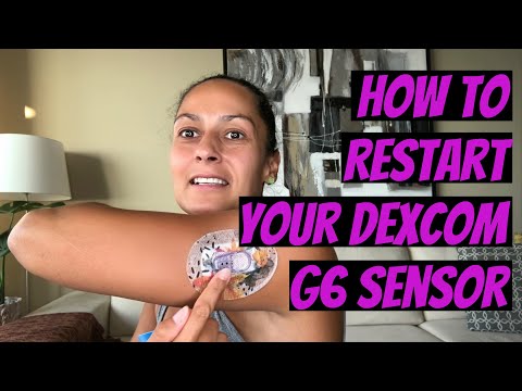 How to Restart Your Dexcom G6 Sensor