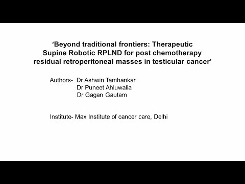 Beyond Traditional Frontiers: Therapeutic Supine Robotic RPLND for post-chemotherapy residual retroperitoneal masses in testicular cancer