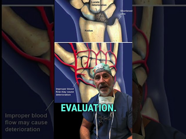 What is Kienbock’s Disease ? Dr. Badia Explains