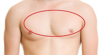 how to get rid of an air bubble in your chest