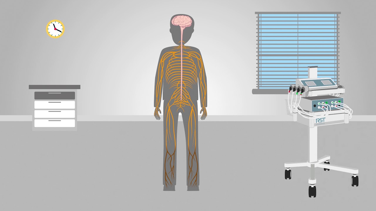 Subretinal fluid a novel approach to macular holes Sci Ani