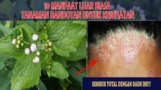 Download lagu 10 MANFAAT DAUN BANDOTAN UNTUK KESEHATAN TUBUH mp3 Download lagu 10 MANFAAT DAUN BANDOTAN UNTUK KESEHATAN TUBUH mp3
