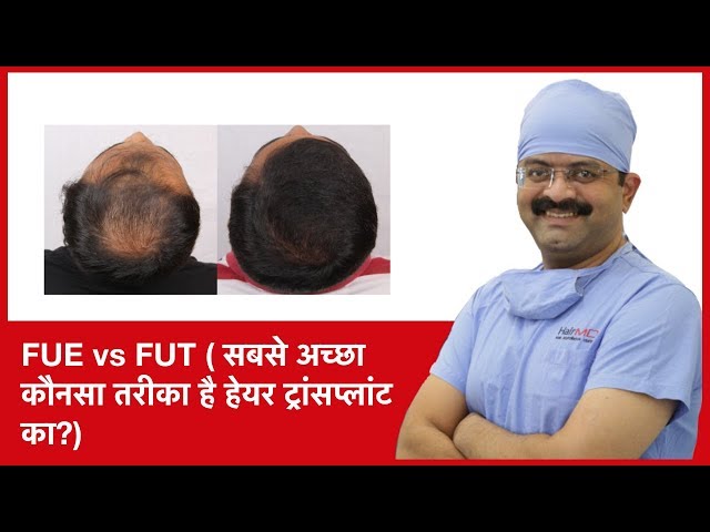 Video Pronunciation of fue in English