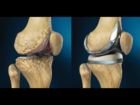 Conversations with Jaguars - March 15 ($ZBH, $CNTY, $MTBC, $SNP)